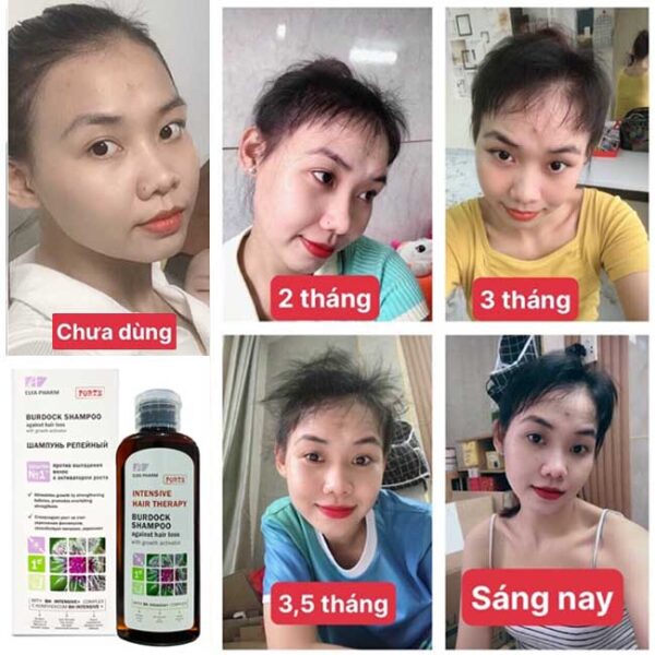 dầu gội chống rụng tóc kích thích mọc tóc elfa pharm - hình ảnh 4